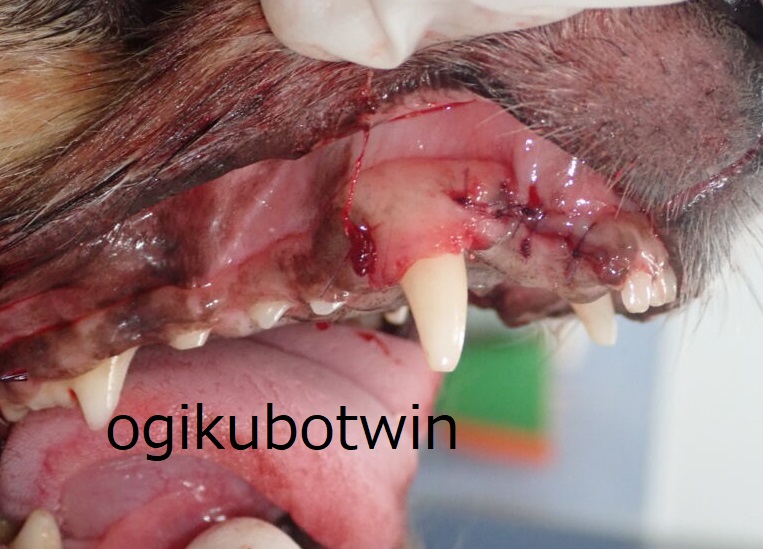 犬歯　再生治療　治療後